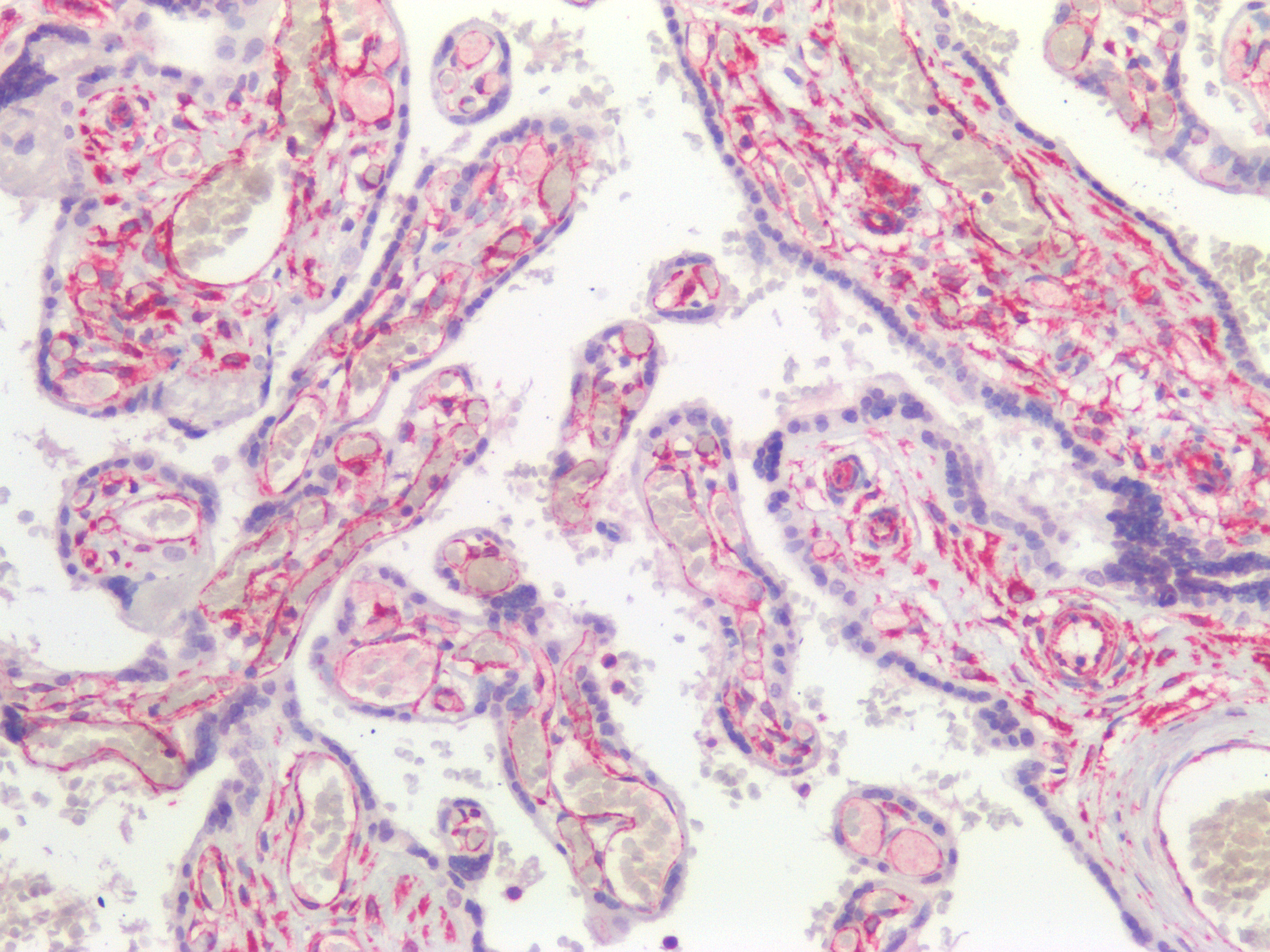 Figure 9. Immunohistochemistry on formalin fixed, paraffin embedded section of human placenta showing positive staining in connective tissue cells and no reactivity in epithelial cells.